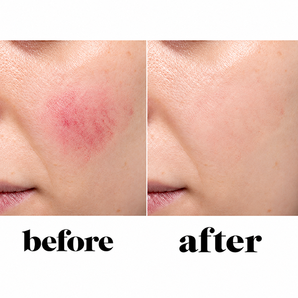 Ben Nye Red Neutralizer